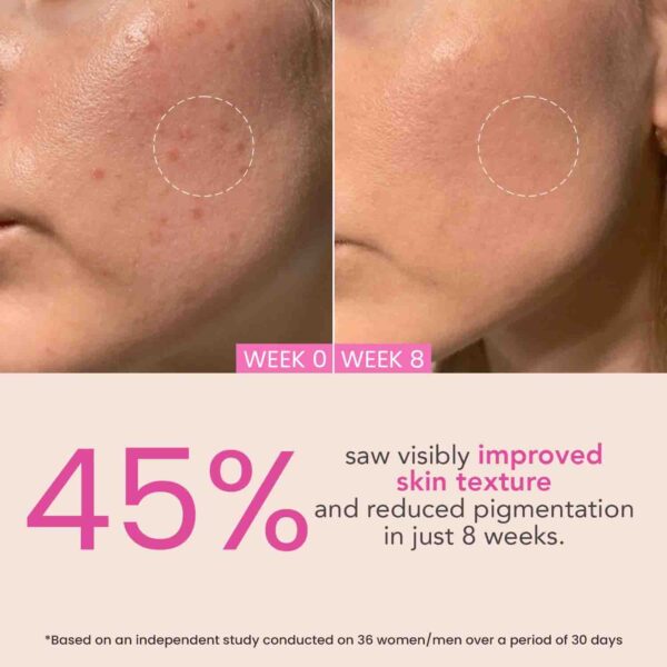 O3+ Night Repair Cream for Smoother & Radiant Skin
