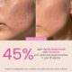 O3+ Night Repair Cream for Smoother & Radiant Skin